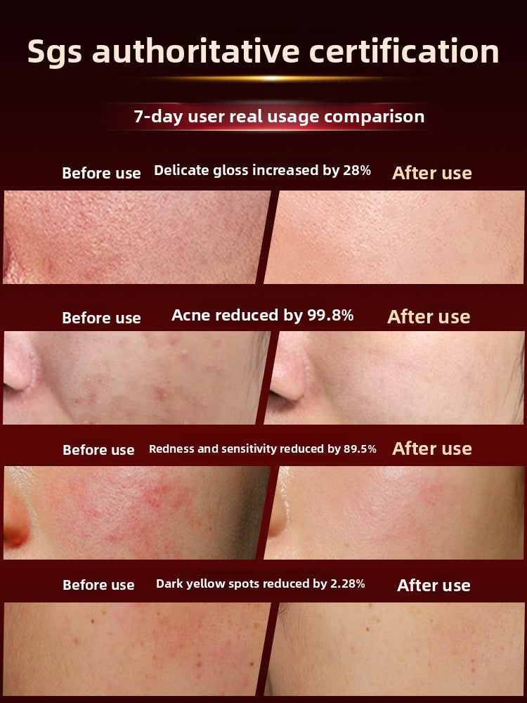 Velisse Photon LED Therapy Mask — Face & Body